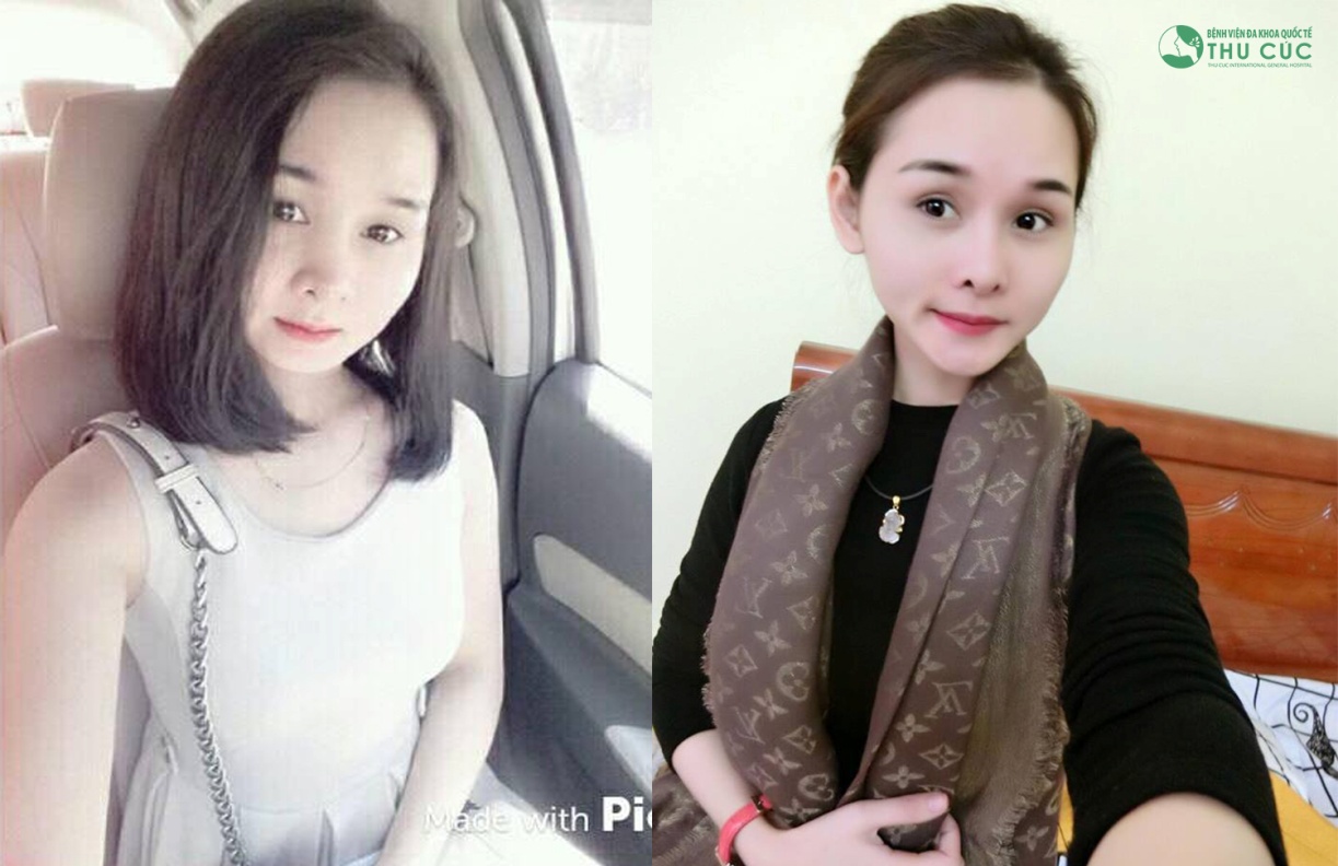 Nữ 9X cực rạng rỡ, tự tin với nhan sắc sau thẩm mỹ - Ảnh 1. Nữ 9X cực rạng rỡ, tự tin với nhan sắc sau thẩm mỹ - Ảnh 1.