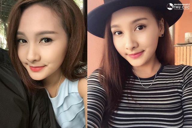 Diễn viên Bảo Thanh chia sẻ sau khi làm thẩm mỹ - Ảnh 6.