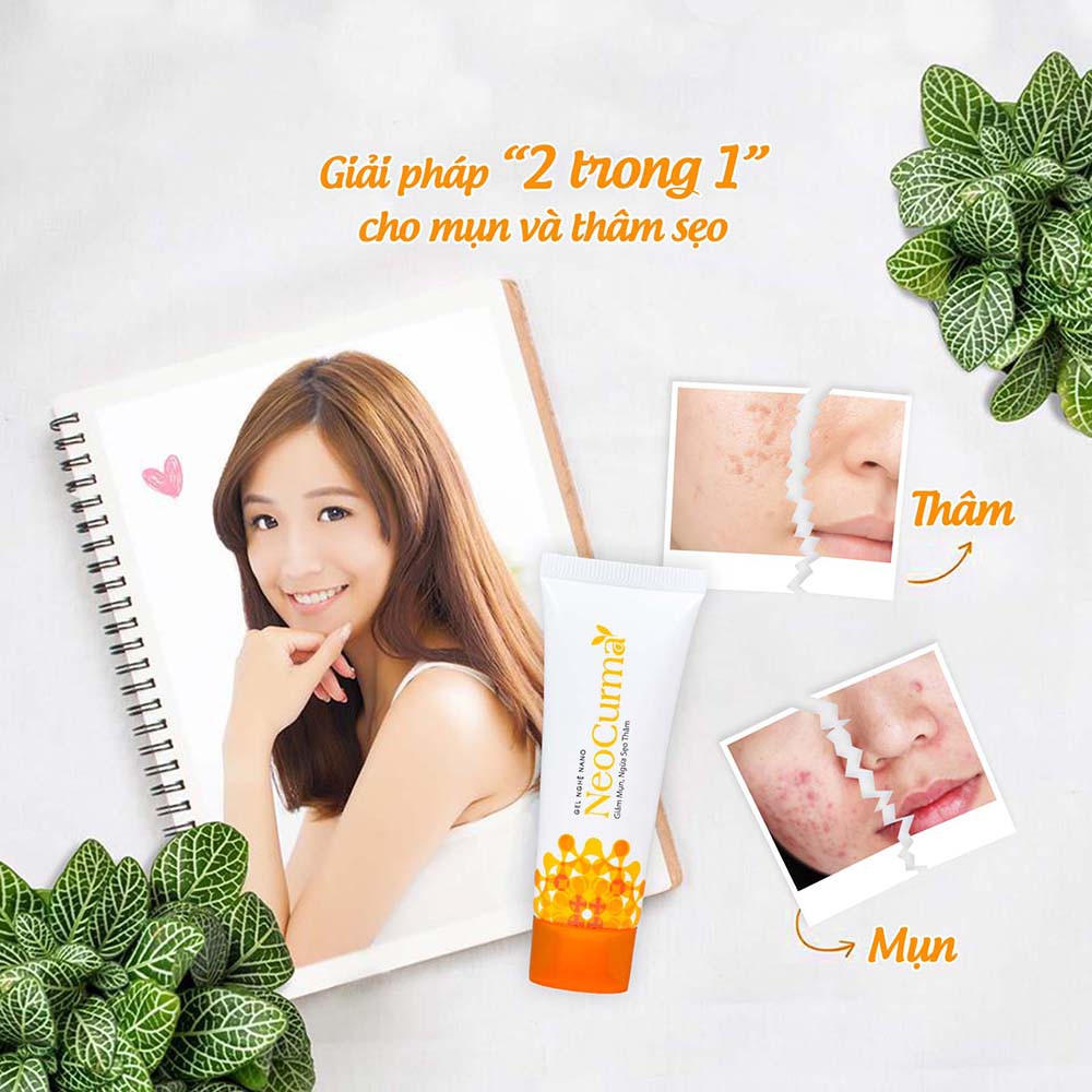 Hồ biến da sạch mụn hết thâm chỉ nhờ một bảo bối nhỏ này đây! - Ảnh 3. Hồ biến da sạch mụn hết thâm chỉ nhờ một bảo bối nhỏ này đây! - Ảnh 3.