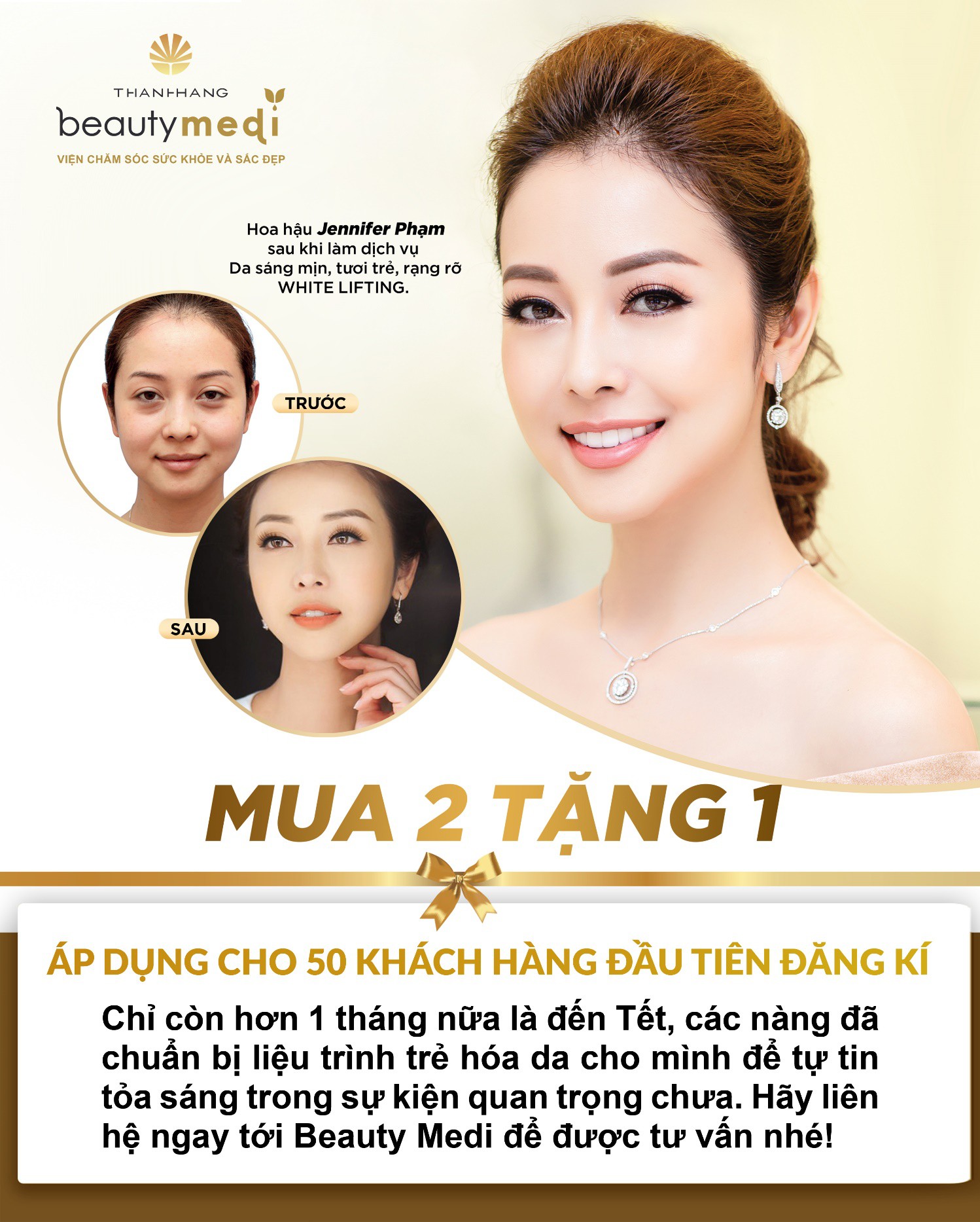 Dù mai là Tết thì da vẫn kịp đẹp bất chấp hết nhờ phương pháp này - Ảnh 5. Dù mai là Tết thì da vẫn kịp đẹp bất chấp hết nhờ phương pháp này - Ảnh 5.