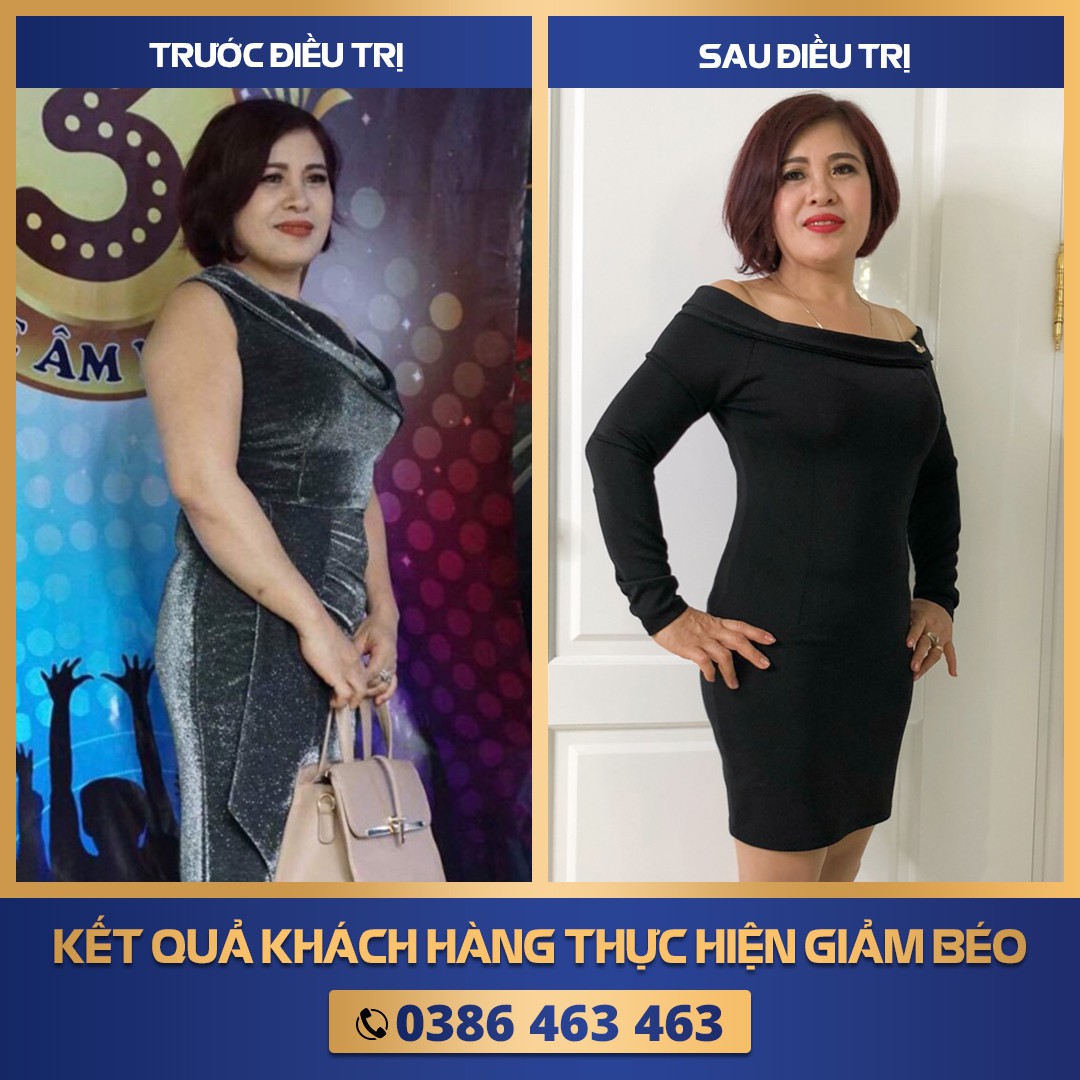 Lipo Slimming – Siêu phẩm giảm béo 4 in 1, loại bỏ cấp tốc mỡ thừa chỉ 1 lần - Ảnh 3. Lipo Slimming – Siêu phẩm giảm béo 4 in 1, loại bỏ cấp tốc mỡ thừa chỉ 1 lần - Ảnh 3.