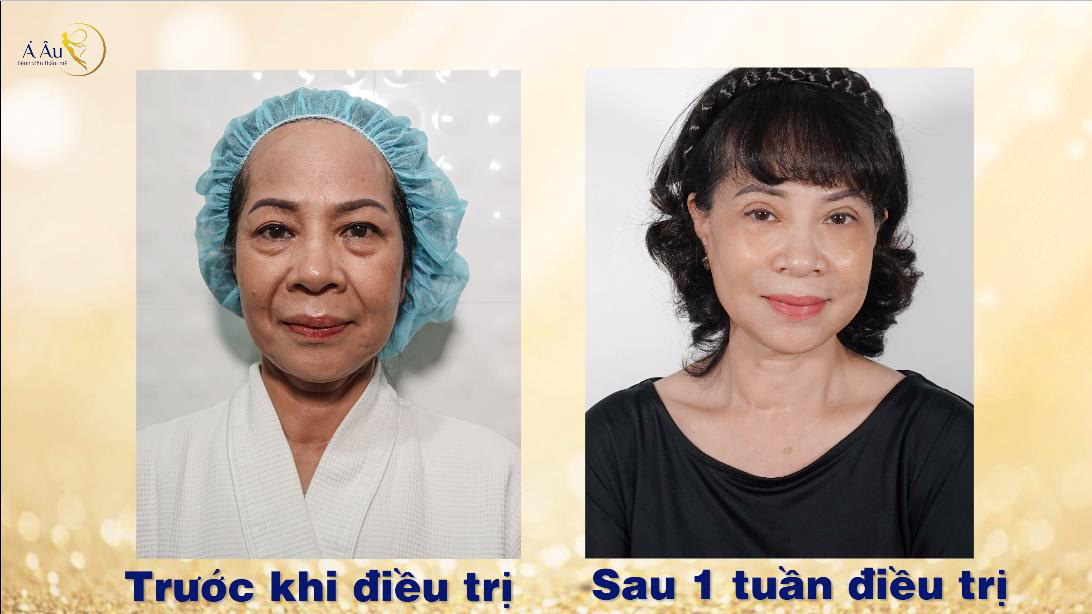 Siêu mẫu Thúy Hạnh hiếu thuận tặng mẹ món quà trở về tuổi xuân - Ảnh 3. Siêu mẫu Thúy Hạnh hiếu thuận tặng mẹ món quà trở về tuổi xuân - Ảnh 3.