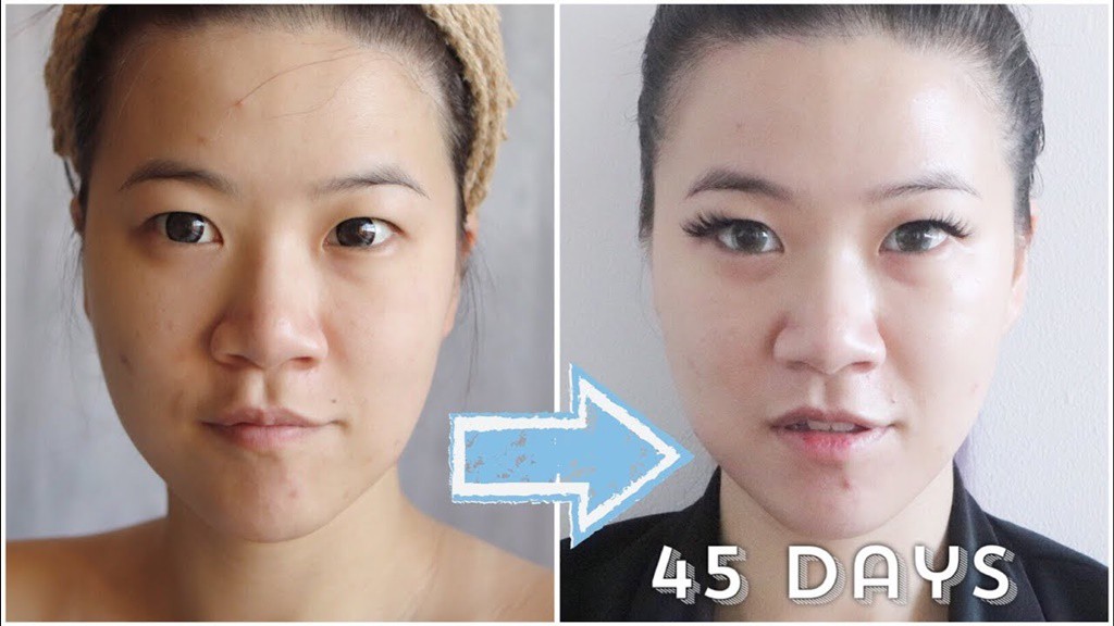 Xóa tan nỗi lo mùa nồm ẩm, đây là giải pháp dưỡng da được chị em rỉ tai nhau suốt thời gian qua - Ảnh 5. Xóa tan nỗi lo mùa nồm ẩm, đây là giải pháp dưỡng da được chị em rỉ tai nhau suốt thời gian qua - Ảnh 5.