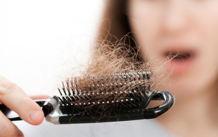 Tóc rụng nhiều, đây là cách đơn giản để tránh bị hói đầu cho cả nam và nữ - Ảnh 1. Tóc rụng nhiều, đây là cách đơn giản để tránh bị hói đầu cho cả nam và nữ - Ảnh 1.