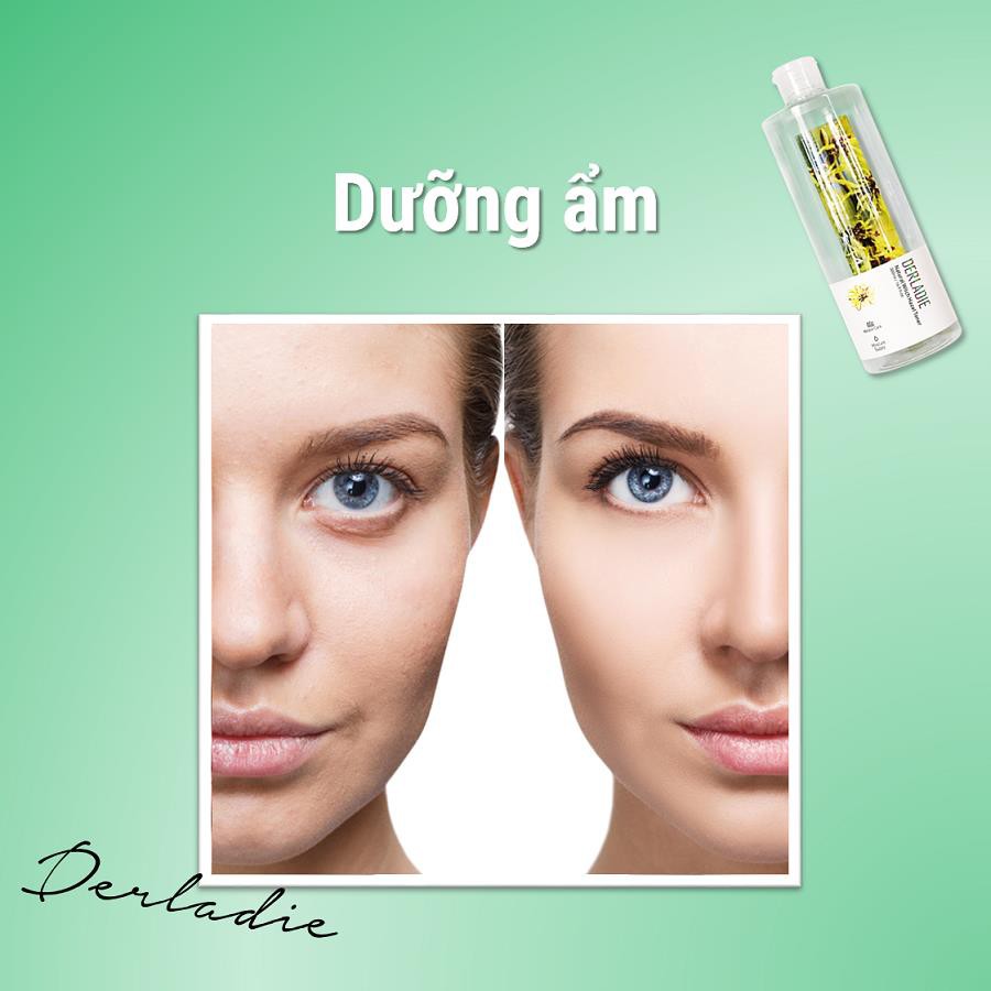 Bắt trend 2019: Ngăn ngừa mụn chỉ với một lọ toner, tưởng đùa hóa ra là thật? - Ảnh 6. Bắt trend 2019: Ngăn ngừa mụn chỉ với một lọ toner, tưởng đùa hóa ra là thật? - Ảnh 6.