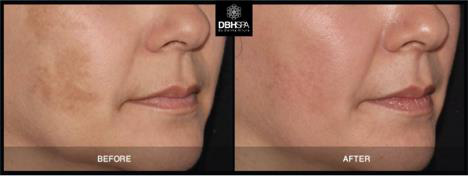 Dermaesthetics Beverly Hills đồng hành cùng phái đẹp trên hành trình chăm sóc làn da - Ảnh 3.