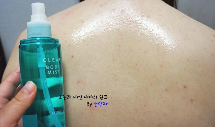 Lưng mụn, không thể mặc áo hở vai? Đấy là vì bạn chưa biết đến Clear Body Mist - Ảnh 7. Lưng mụn, không thể mặc áo hở vai? Đấy là vì bạn chưa biết đến Clear Body Mist - Ảnh 7.