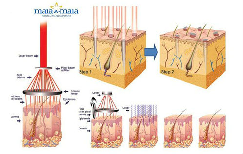 Giải quyết triệt để nỗi ám ảnh rạn da sau sinh chỉ với những “tuyệt chiêu” này - Ảnh 4.