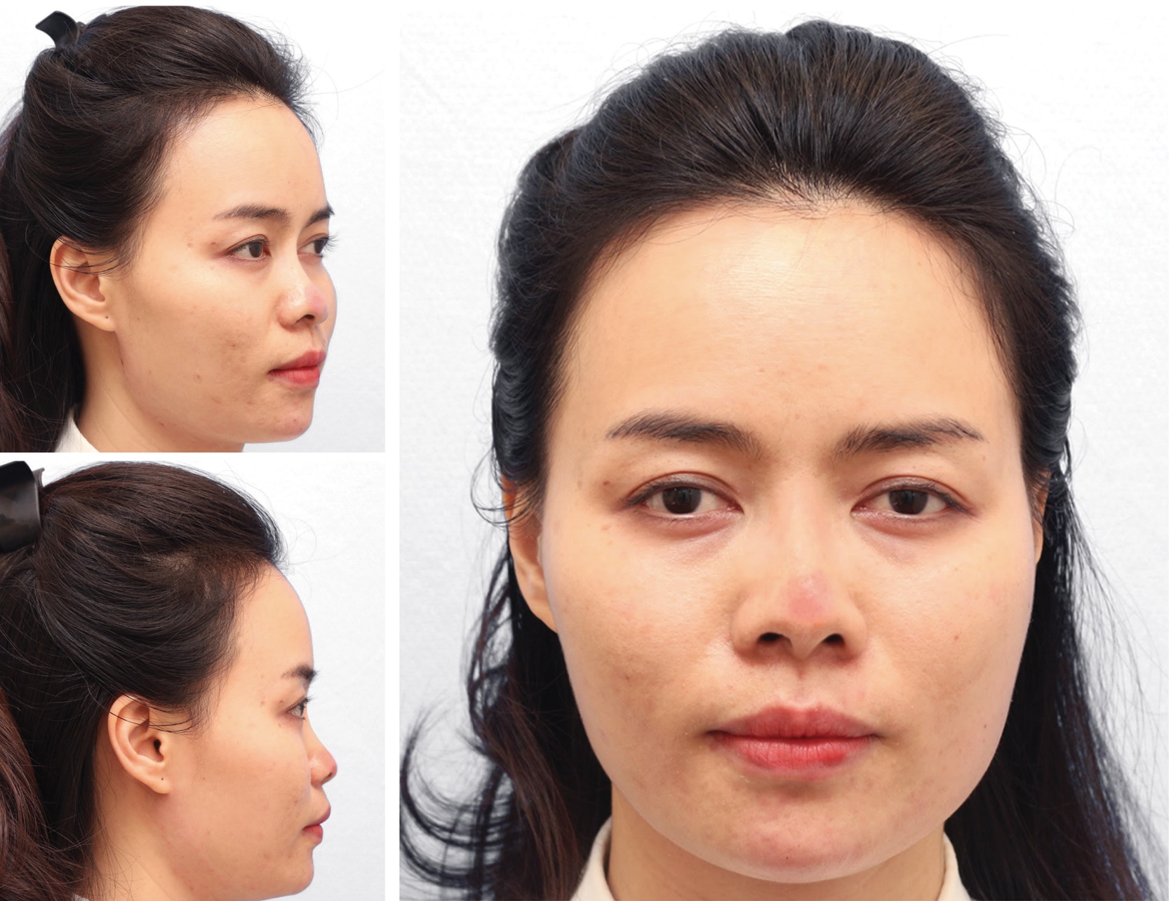 Ca sĩ T&ocirc; Minh Thắng từng mất ăn mất ngủ v&igrave; chiếc mũi của vợ - Ảnh 3.