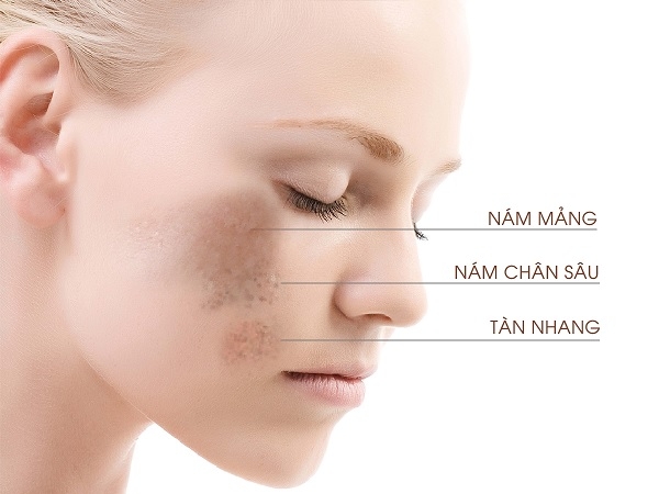 Đ&acirc;u mới l&agrave; khắc tinh của n&aacute;m v&agrave; t&agrave;n nhang? - Ảnh 3.