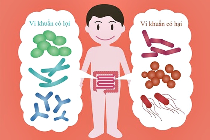 Bổ sung men vi sinh cho trẻ: vô hiệu nếu tỉ lệ lợi khuẩn sống sót trong ruột thấp - Ảnh 1. Bổ sung men vi sinh cho trẻ: vô hiệu nếu tỉ lệ lợi khuẩn sống sót trong ruột thấp - Ảnh 1.