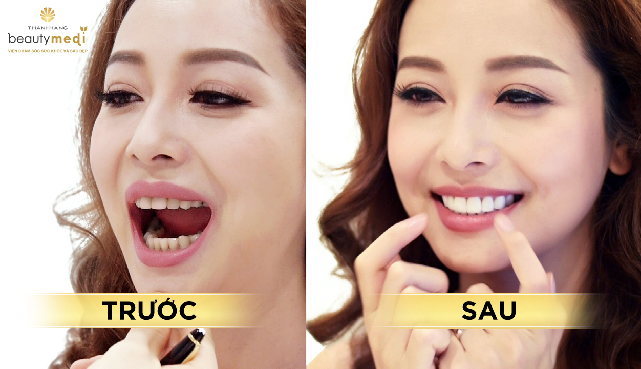 Nhìn lại hành trình thay đổi sắc hạng khoa hậu hĩnh Jennifer Phạm - hình 5. Nhìn lại hành ta đệ trình thay đổi dung nhan mức huơ hậu hĩnh Jennifer Phạm - hình 5.