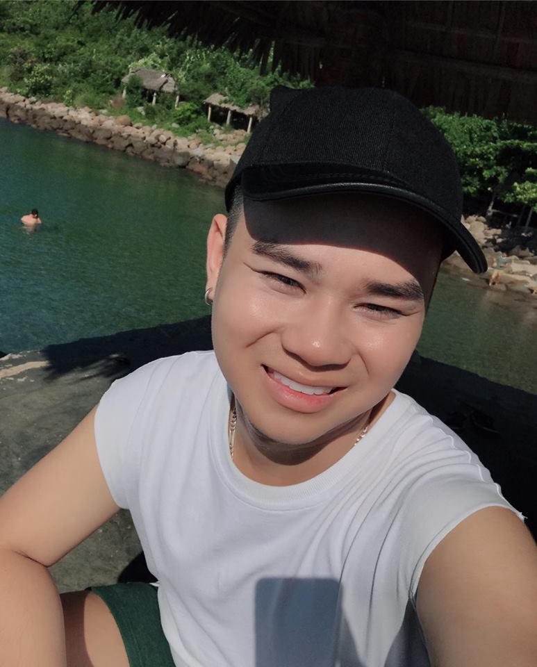 Tự ti về ngoại hình, chàng trai 9x quyết định phẫu thuật thẩm mỹ để thuận lợi hơn trong công việc - Ảnh 2. Tự ti về ngoại hình, chàng trai 9x quyết định phẫu thuật thẩm mỹ để thuận lợi hơn trong công việc - Ảnh 2.