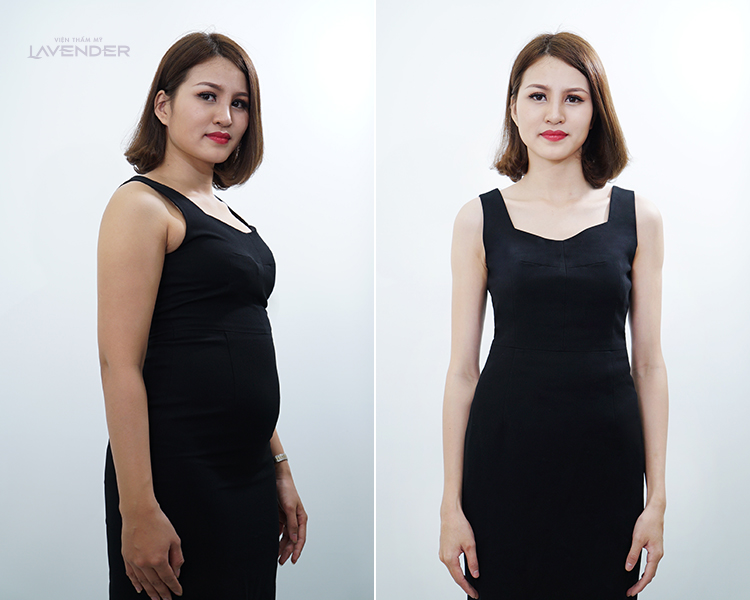 Thực tế đã chứng minh: Ai cũng có thể mặc đẹp, miễn là bạn phải gầy - Ảnh 5. Thực tế đã chứng minh: Ai cũng có thể mặc đẹp, miễn là bạn phải gầy - Ảnh 5.