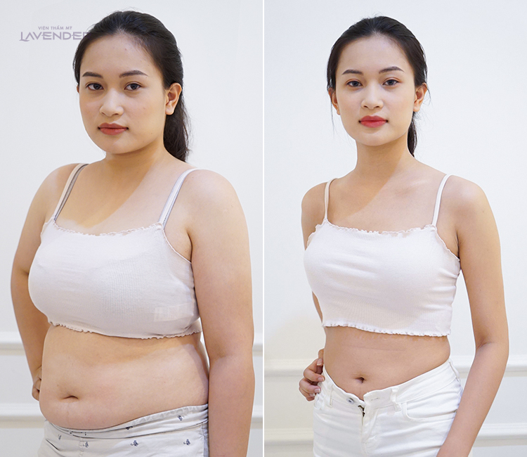 Thực tế đã chứng minh: Ai cũng có thể mặc đẹp, miễn là bạn phải gầy - Ảnh 6. Thực tế đã chứng minh: Ai cũng có thể mặc đẹp, miễn là bạn phải gầy - Ảnh 6.