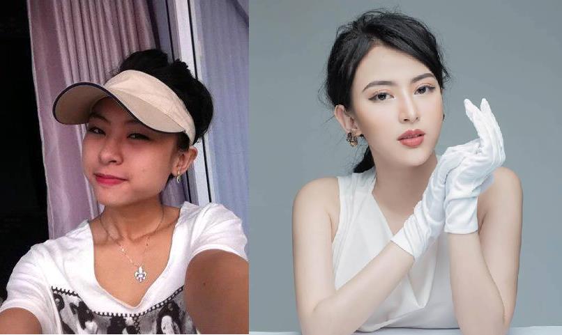 Nghiện làm đẹp, cô gái 9x tiên phong thử nghiệm thẩm mỹ không dao kéo trên chính bản thân mình - Ảnh 2. Nghiện làm đẹp, cô gái 9x tiên phong thử nghiệm thẩm mỹ không dao kéo trên chính bản thân mình - Ảnh 2.
