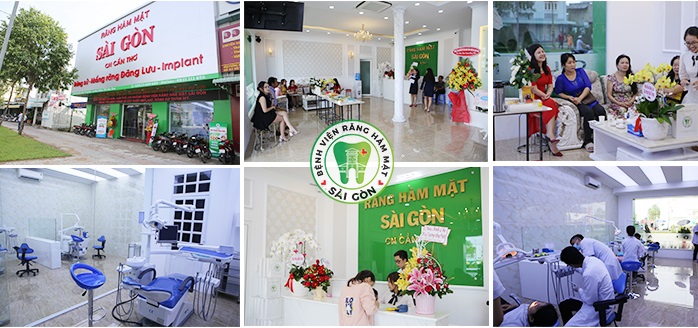 Nhiều khuyến mãi làm răng tại phòng khám chuyên khoa răng hàm mặt Sài Gòn Cần Thơ - Ảnh 2. Nhiều khuyến mãi làm răng tại phòng khám chuyên khoa răng hàm mặt Sài Gòn Cần Thơ - Ảnh 2.