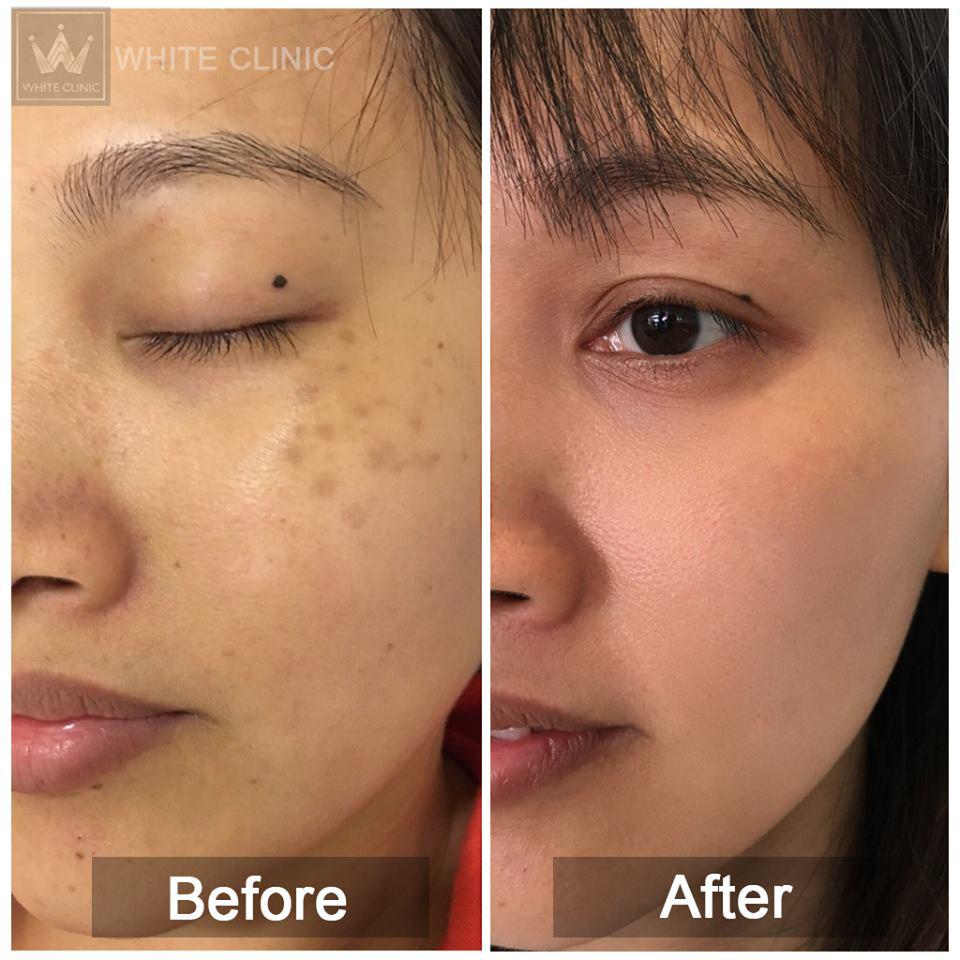 4 lý do hội bạn gái mê làm đẹp check-in rần rần tại White Clinic - Ảnh 5. 4 lý do hội bạn gái mê làm đẹp check-in rần rần tại White Clinic - Ảnh 5.