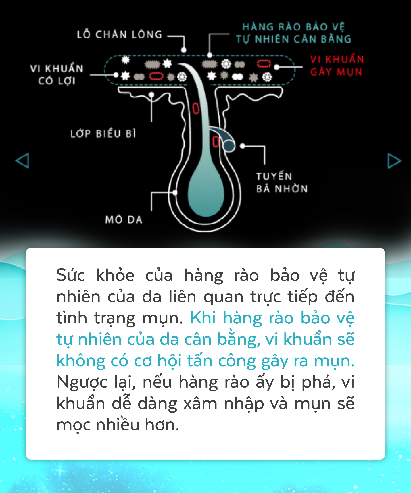 Bỏ tiền mua mỹ phẩm xịn nhưng mụn vẫn hoành hành, nguyên nhân vì đâu? - Ảnh 3. Bỏ tiền mua mỹ phẩm xịn nhưng mụn vẫn hoành hành, nguyên nhân vì đâu? - Ảnh 3.