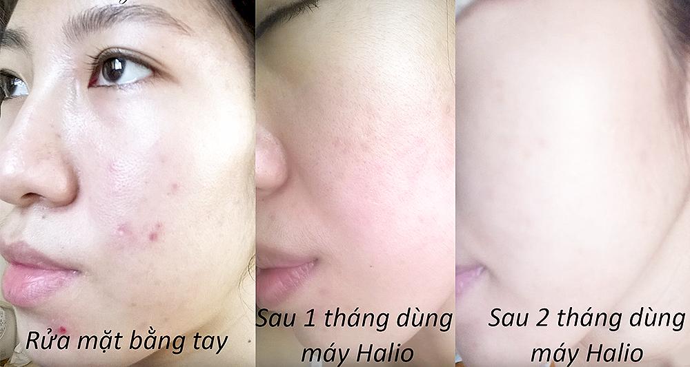“Mổ xẻ bảo bối máy rửa mặt của Đào Bá Lộc cho làn da khiến hội chị em ghen tị - Ảnh 14. “Mổ xẻ bảo bối máy rửa mặt của Đào Bá Lộc cho làn da khiến hội chị em ghen tị - Ảnh 14.