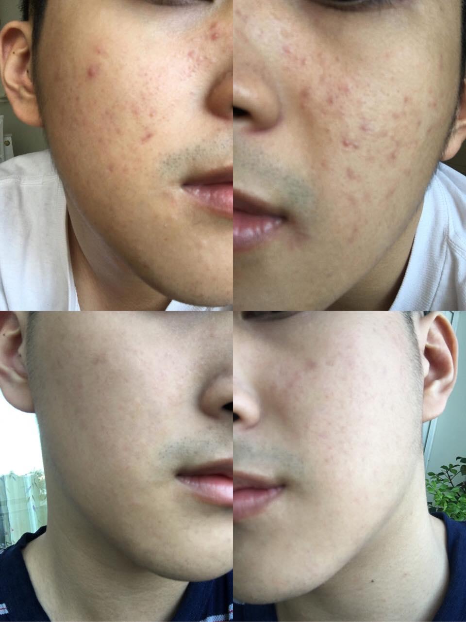 Ngày qua tháng lại dùng thứ này và đây là những review có tâm nhất từ các hotteen - Ảnh 5. Ngày qua tháng lại dùng thứ này và đây là những review có tâm nhất từ các hotteen - Ảnh 5.