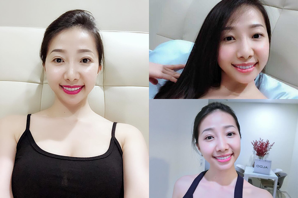 Cho Nami – Bí kíp giải cứu làn da tổn thương hiệu quả không chỉ cho chị em phụ nữ - Ảnh 4. Cho Nami – Bí kíp giải cứu làn da tổn thương hiệu quả không chỉ cho chị em phụ nữ - Ảnh 4.