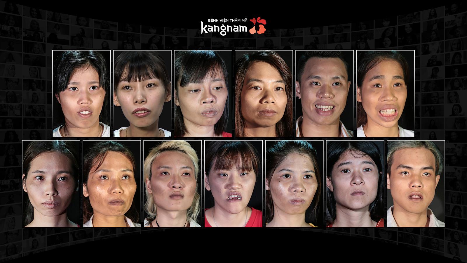 Chương trình thực tế về phẫu thuật thẩm mỹ - “Món ăn” độc lạ cho khán giả truyền hình - Ảnh 3. Chương trình thực tế về phẫu thuật thẩm mỹ - “Món ăn” độc lạ cho khán giả truyền hình - Ảnh 3.