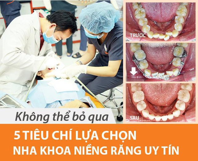 Địa chỉ niềng răng uy tín: 5 tiêu chí chọn nha khoa bạn nên biết - Ảnh 1.