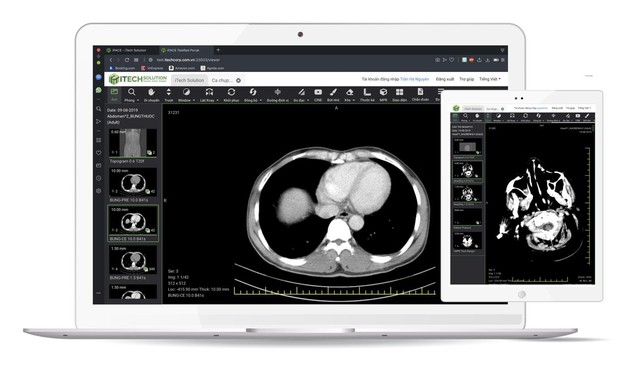 Ra mắt ứng dụng chẩn đoán hình ảnh IPACS Telerad “make in Việt Nam” - Ảnh 1.