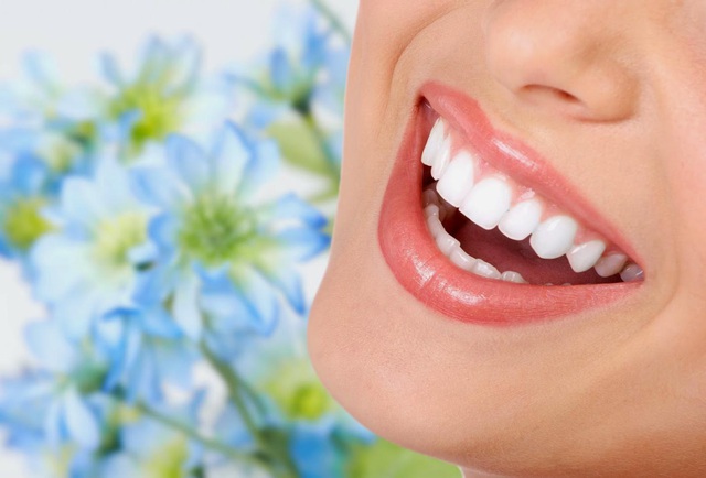Xu hướng bọc răng sứ của người trẻ hiện đại - Ảnh 3.