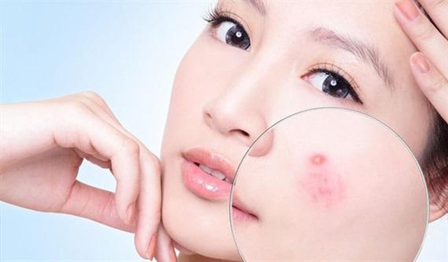 Dưỡng da khoa học với 5 bộ skincare đình đám từ Vichy và La Roche Posay cho mùa hè - Ảnh 7.