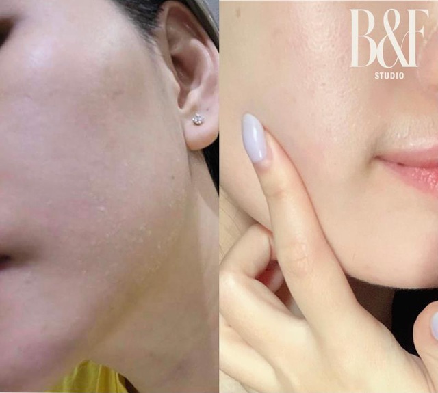 Mùa đông phải mua loại sữa rửa mặt này thì da mới láng sạch, mướt mịn và quan trọng là không bong tróc bạn ơi! - Ảnh 4.