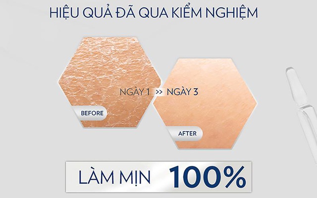 AHA, HA và Niacinamide có trong dưỡng thể liệu có đáng “đồng tiền bát gạo? - Ảnh 8.