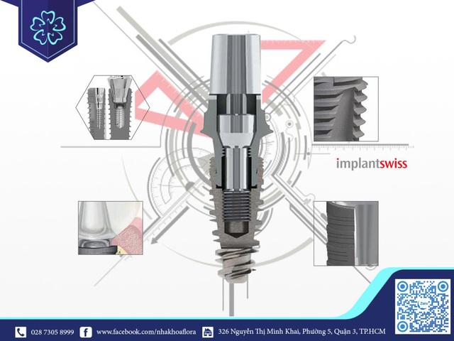 Tại sao bạn nên lựa chọn nha khoa uy tín để trồng răng Implant? - Ảnh 1.