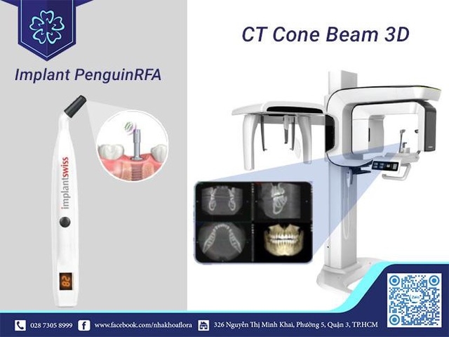 Tại sao bạn nên lựa chọn nha khoa uy tín để trồng răng Implant? - Ảnh 2.