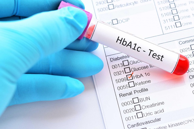 ALA-Bio: Hơn 20 năm nghiên cứu về hỗ trợ điều trị tiểu đường - Ảnh 1.