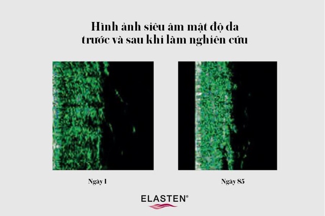 ELASTEN® Việt Nam - Liệu pháp dưỡng cấu trúc da tươi trẻ từ bên trong đến từ Đức - Ảnh 1. ELASTEN® Việt Nam - Liệu pháp dưỡng cấu trúc da tươi trẻ từ bên trong đến từ Đức - Ảnh 1.