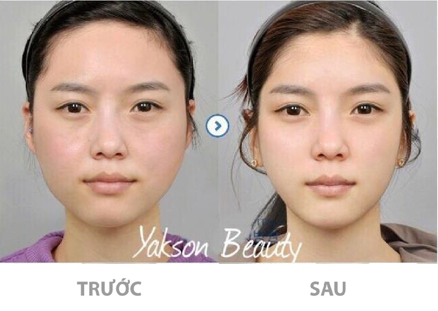 Yakson Beauty - Chặng đường phát triển với nhiều dấu ấn của thương hiệu làm đẹp tự nhiên tại Việt Nam - Ảnh 2.