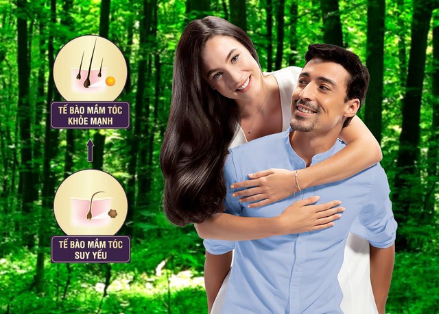Giải pháp khắc phục rụng tóc từ sớm cho các ông bố và bà mẹ trẻ - Ảnh 1. Giải pháp khắc phục rụng tóc từ sớm cho các ông bố và bà mẹ trẻ - Ảnh 1.