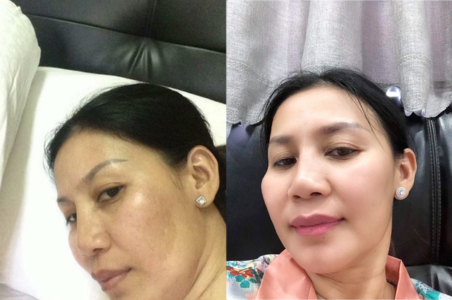 H&agrave;nh tr&igrave;nh thay đổi kỳ diệu của l&agrave;n da với mỹ phẩm Cho Nami - Ảnh 1.