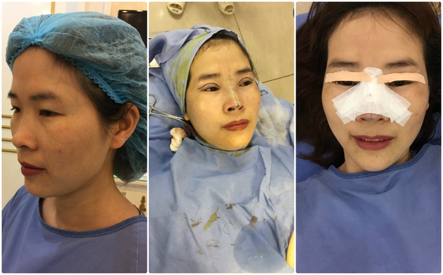 Chẳng cần bỏ ra 200 triệu, bà mẹ 3 con cũng vịt hóa thiên nga thành công - Ảnh 3. Chẳng cần bỏ ra 200 triệu, bà mẹ 3 con cũng vịt hóa thiên nga thành công - Ảnh 3.