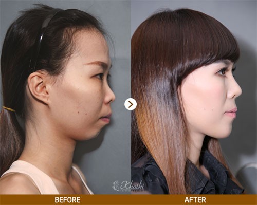6 chiếc mũi của sao Hàn được nhiều người muốn phẫu thuật giống nhất - Ảnh 7.