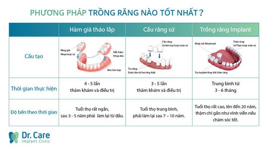 Chọn trồng răng Implant vì chán cảnh làm lại răng sứ - Ảnh 2.