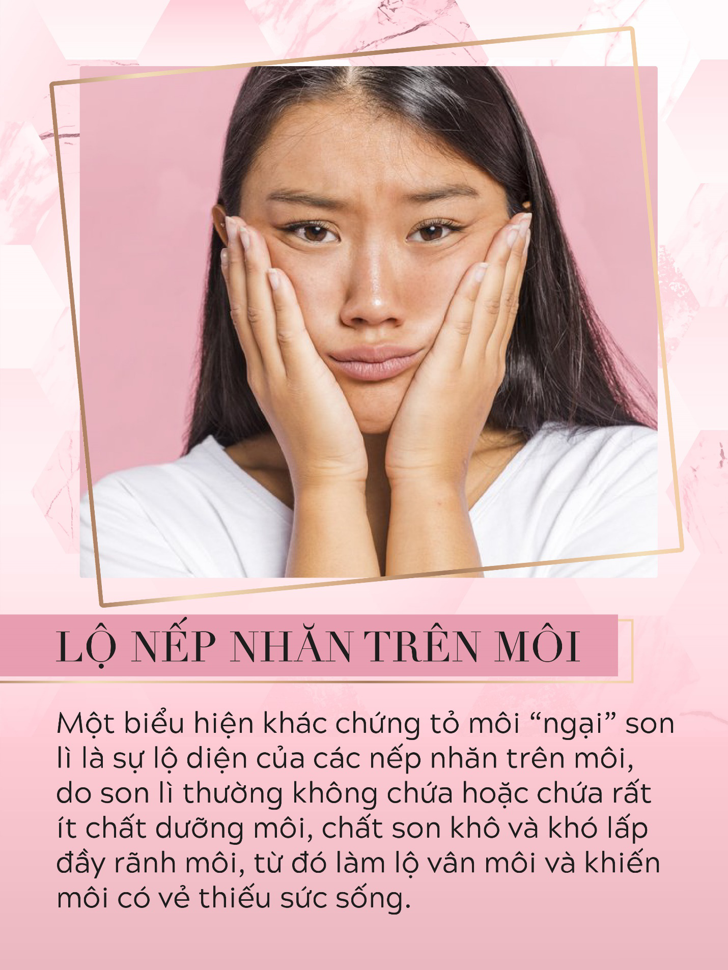 Soi kỹ 5 biểu hiện của đôi môi “ngại” son lì để thấy vì sao phải chọn ngay dòng son trang điểm chứa 50% thành phần dưỡng - Ảnh 3.