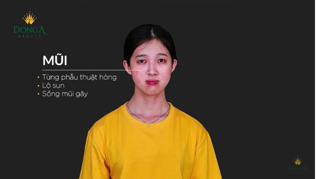 Hành trình tái sinh ngỡ ngàng của cô gái 9x đến từ Bình Dương - Ảnh 7. Hành trình tái sinh ngỡ ngàng của cô gái 9x đến từ Bình Dương - Ảnh 7.