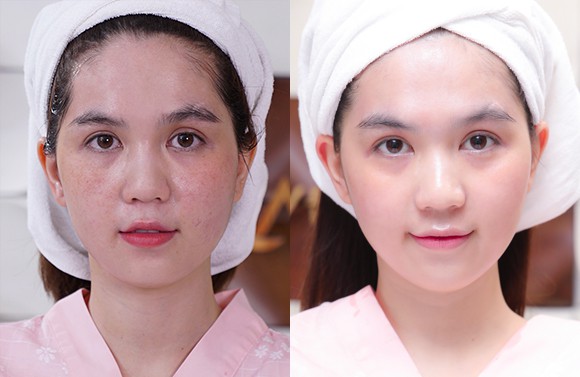 Hết hè đến nơi, học ngay Ngọc Trinh phục hồi nhan sắc toàn diện với loạt phương pháp làm đẹp này - Ảnh 7.