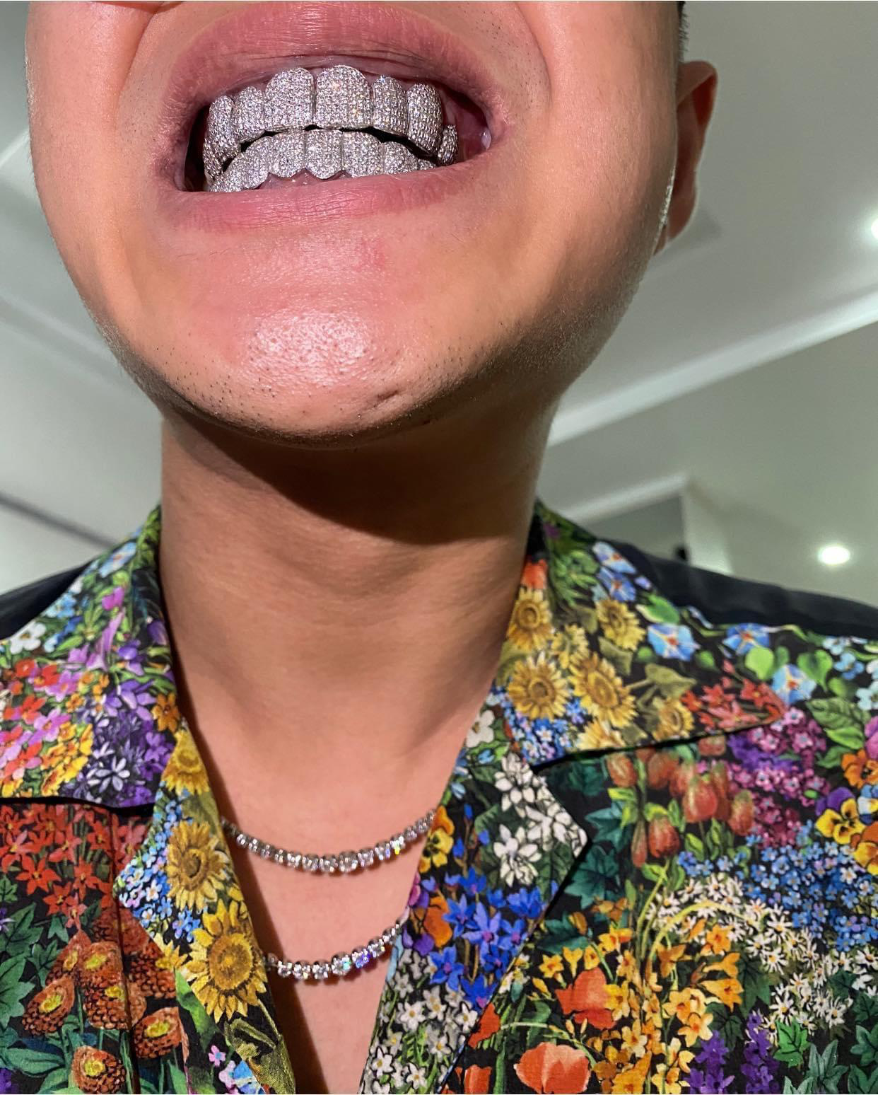 Trang sức răng - Món đồ chơi xa xỉ của sao rap Việt - Ảnh 6. Trang sức răng - Món đồ chơi xa xỉ của sao rap Việt - Ảnh 6.