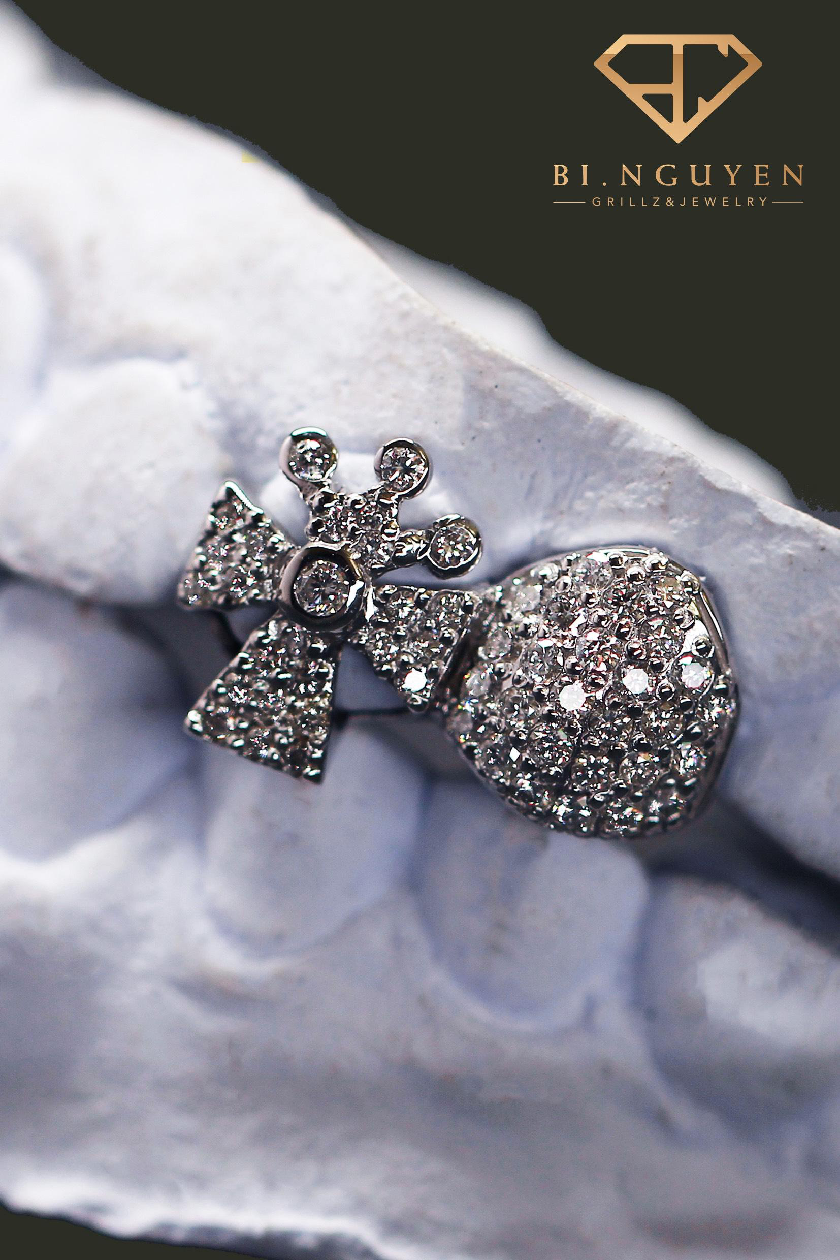 Trang sức răng - M&oacute;n đồ chơi xa xỉ của sao rap Việt - Ảnh 7.