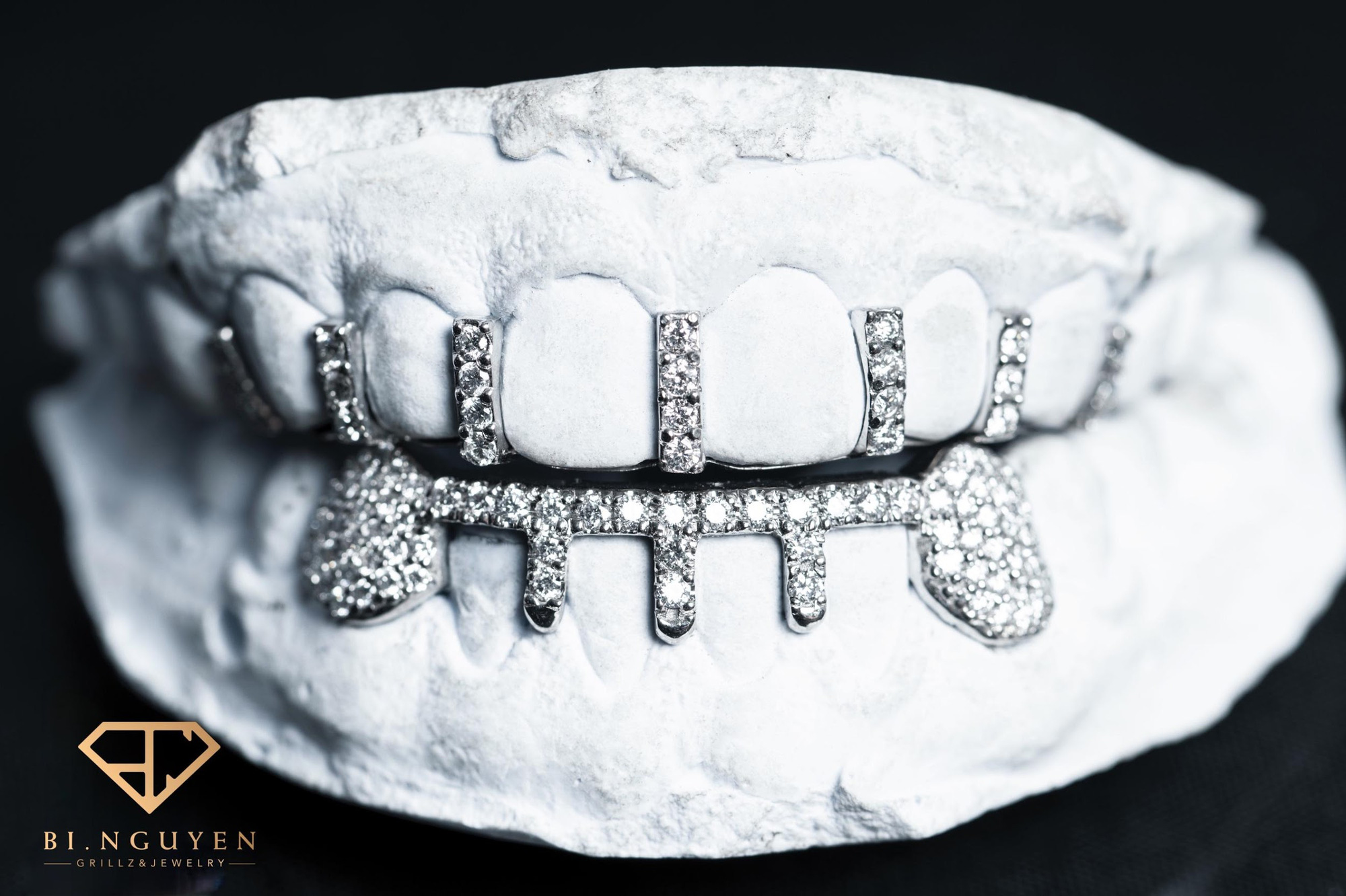 Trang sức răng - M&oacute;n đồ chơi xa xỉ của sao rap Việt - Ảnh 8.