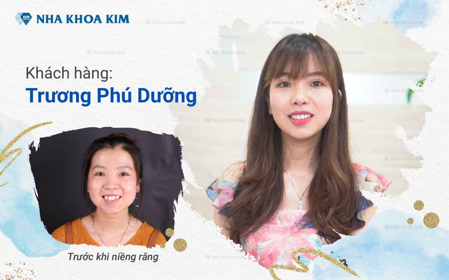 Thay đổi nhan sắc ngoạn mục nhờ niềng răng - Ảnh 1. Thay đổi nhan sắc ngoạn mục nhờ niềng răng - Ảnh 1.